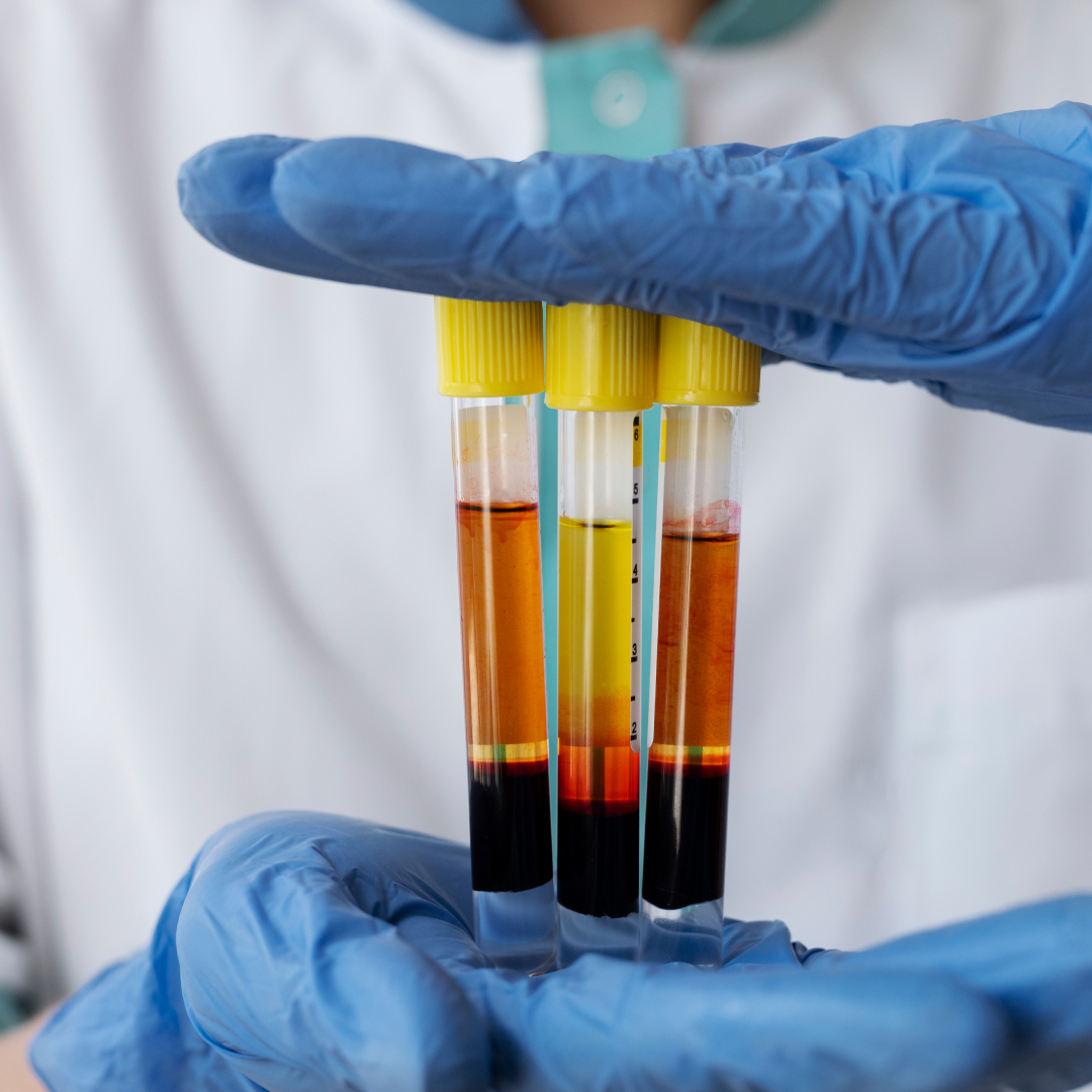 ¿Qué es el Plasma Rico en Plaquetas? - Rebiogral
